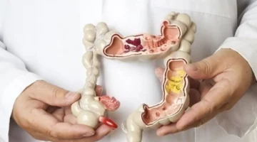 7 خطوات.. تطهير طبيعي للقولون يعزز الهضم ويقضي على الانتفاخ تمامًا